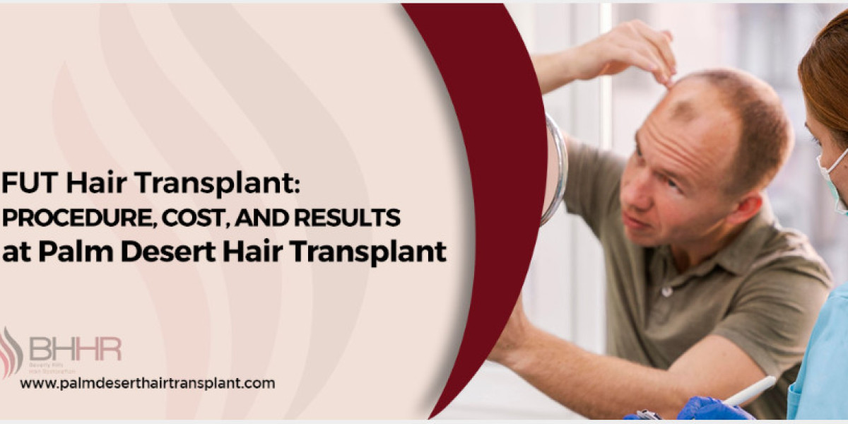 The Benefits of Fut Procedure for Hair Restoration