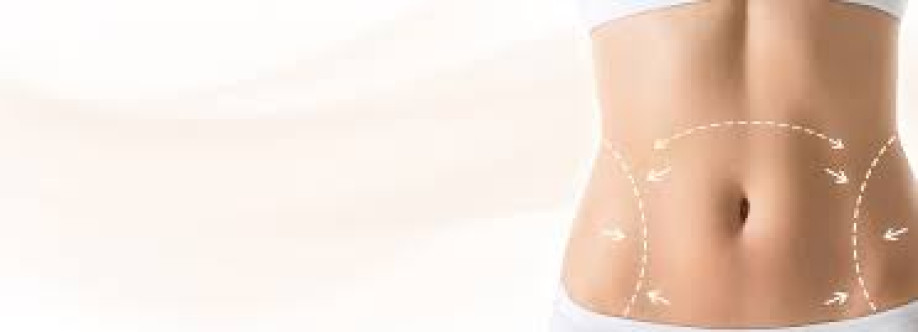 Liposuction Surgery Cover Image
